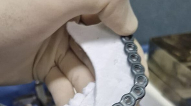 El Hospital de Trenque Lauquen ha realizado ya más de 60 cirugías con impresiones 3D