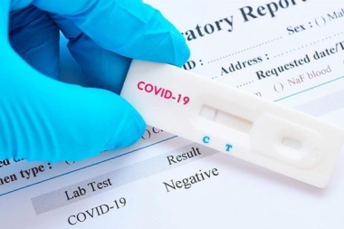 Promueven una ley para regular la venta de test rápidos en farmacias