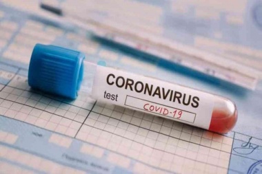 Dio positivo de covid-19 en Junín una persona no residente