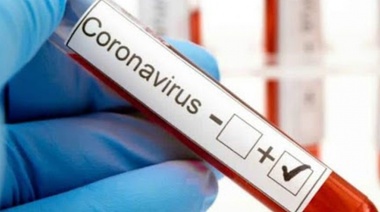 Nuevo positivo de coronavirus de Junín: suman ocho casos activos