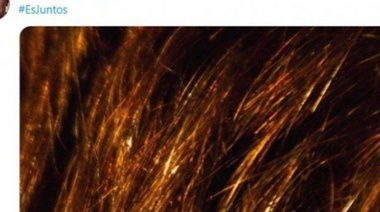 Santilli lanzó su campaña con una llamativa foto en sus redes sociales